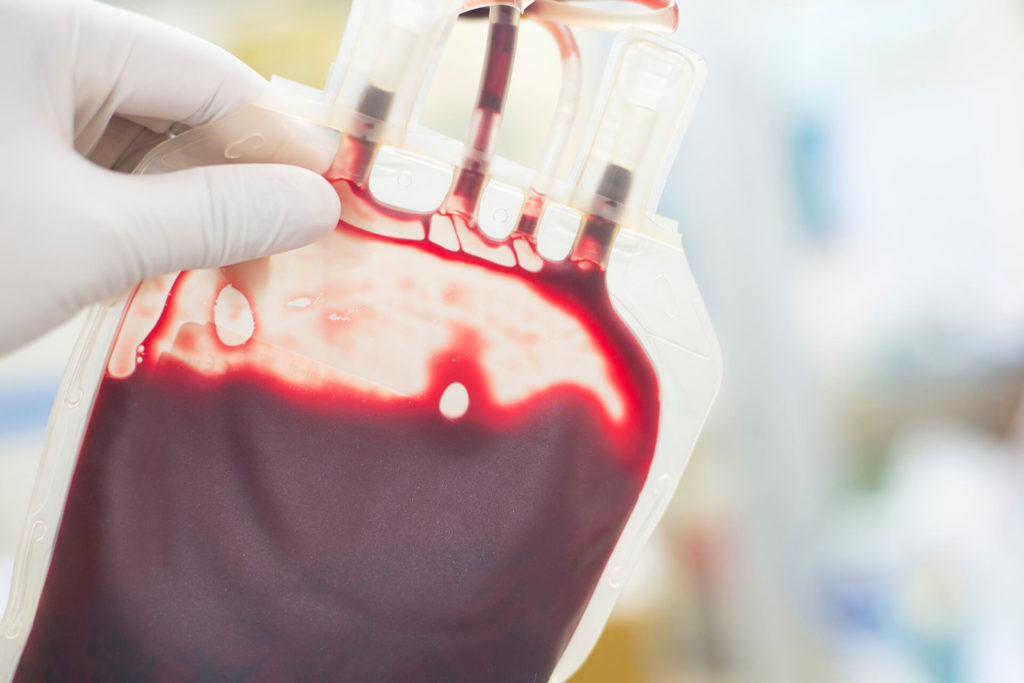 Trasplantedemedulaosea